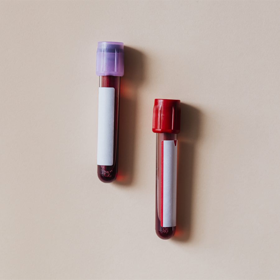 Concentré de globules rouges
