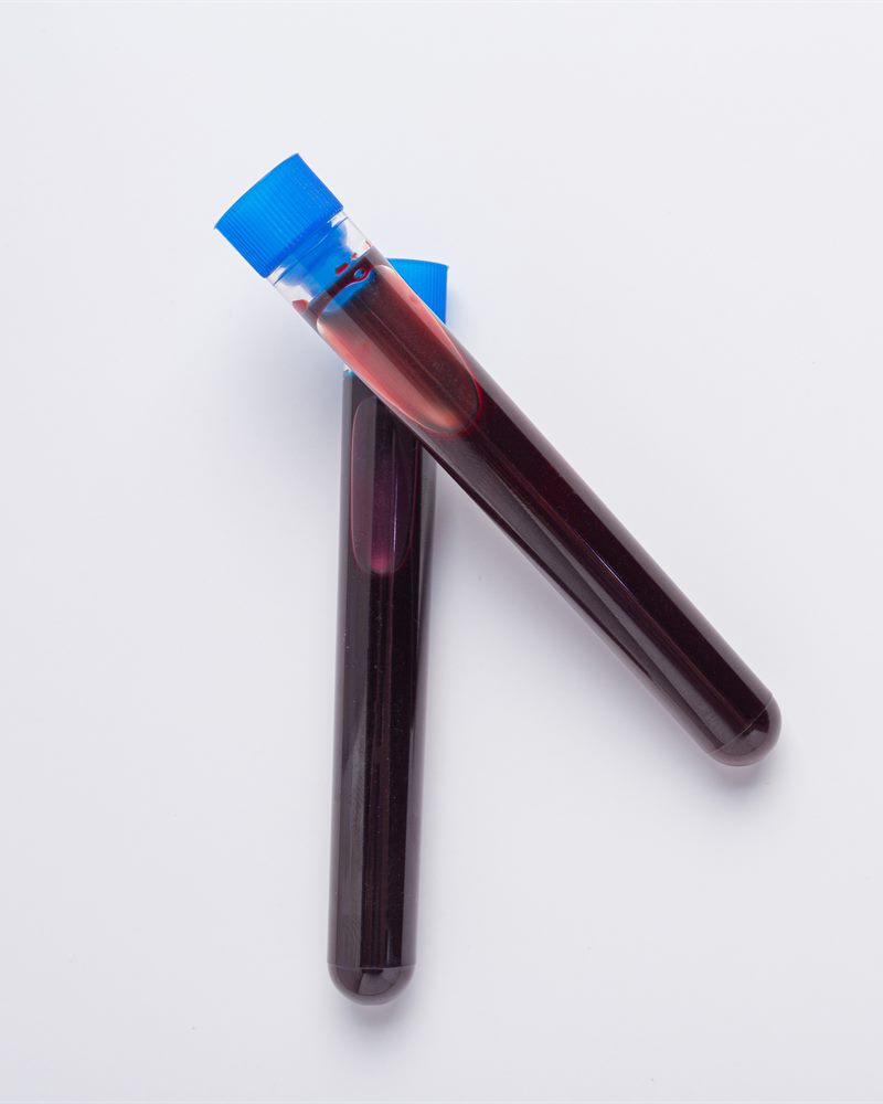 Plasma frais congelé (PFC)